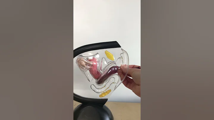 3 reasons your Menstrual Disc is Leaking🩸