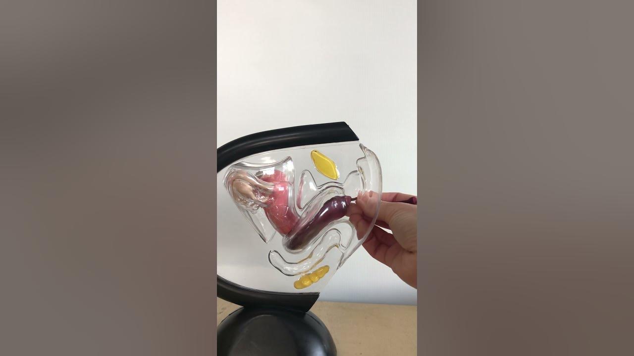 3 reasons your Menstrual Disc is Leaking🩸 YouTube