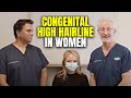 Congenital High Hairline In Women