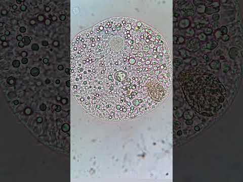 Видео: Структурата на микроскопа