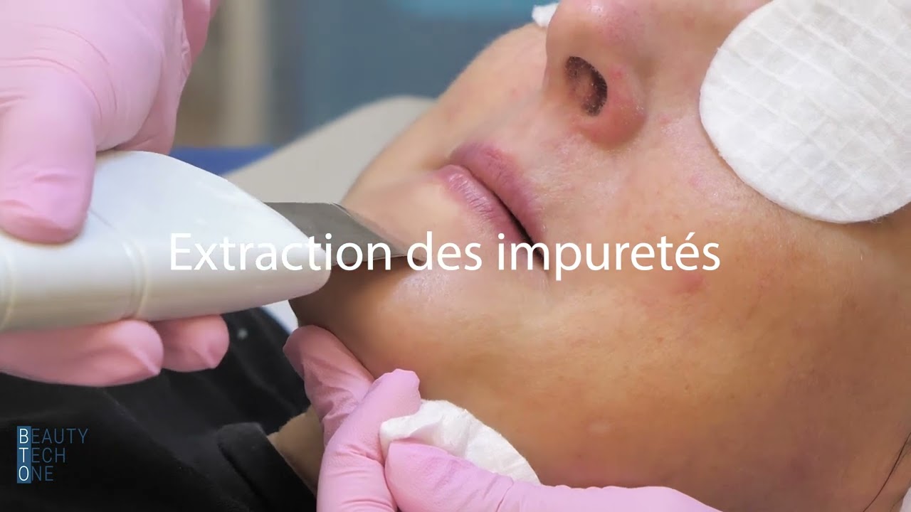 HYDRAFACIAL BY BEAUTY TECH ONE