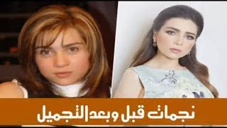 فنانات قبل وبعد عمليات التجميل