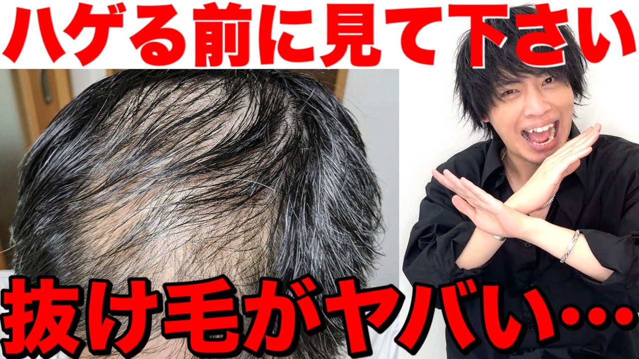 ハゲ対策 男女別抜け毛の原因と５つの対策 薄毛防止 Youtube