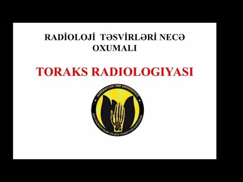 Radioloji Görüntülər Necə Oxunmalı?- Toraks Radiologiya