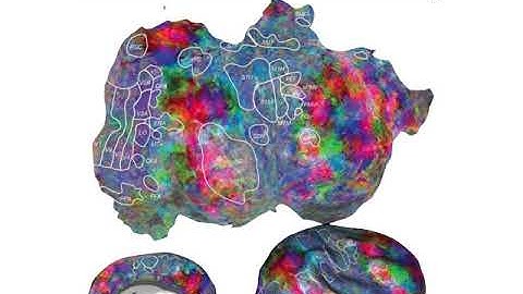 ATCS Lecture 4 Higher visual processing