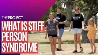 Stiff Person Syndrome: The Progressive Condition That Causes Muscles To Stiffen And Is Incurable