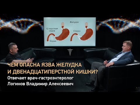 Чем опасна язва желудка и двенадцатиперстной кишки? Отвечает врач-гастроэнтеролог Логинов