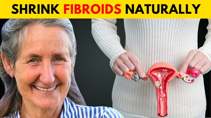12 Foods That Shrink Fibroids (Naturally) | Barbara O’Neill