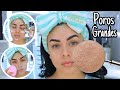 COMO ELIMINAR POROS GRANDES Y PROFUNDOS DEL ROSTRO.