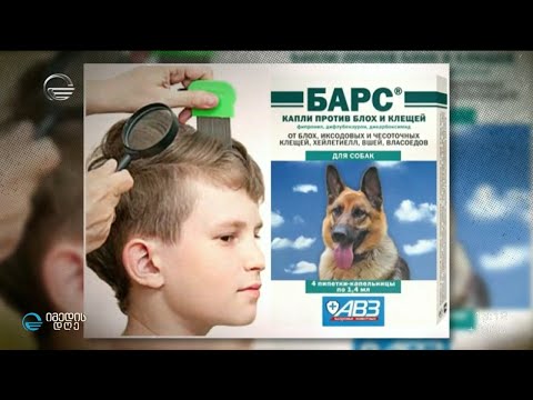 ტილების მოშორების საშიში მეთოდი - სავალალო შედეგები და ექიმების შეფასებები