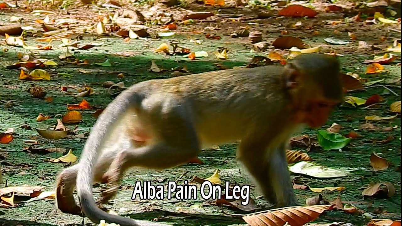 Move With Pain Alba Walk Slowly With Her Leg Pain