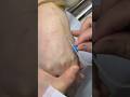 Intramuscular Injection Technique Explained | Safe IM Injection Step-by-Step|Nurse Guide Class 3