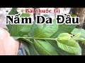 Bài thuốc trị Nấm Da Đầu . PHAN HẢI Channel