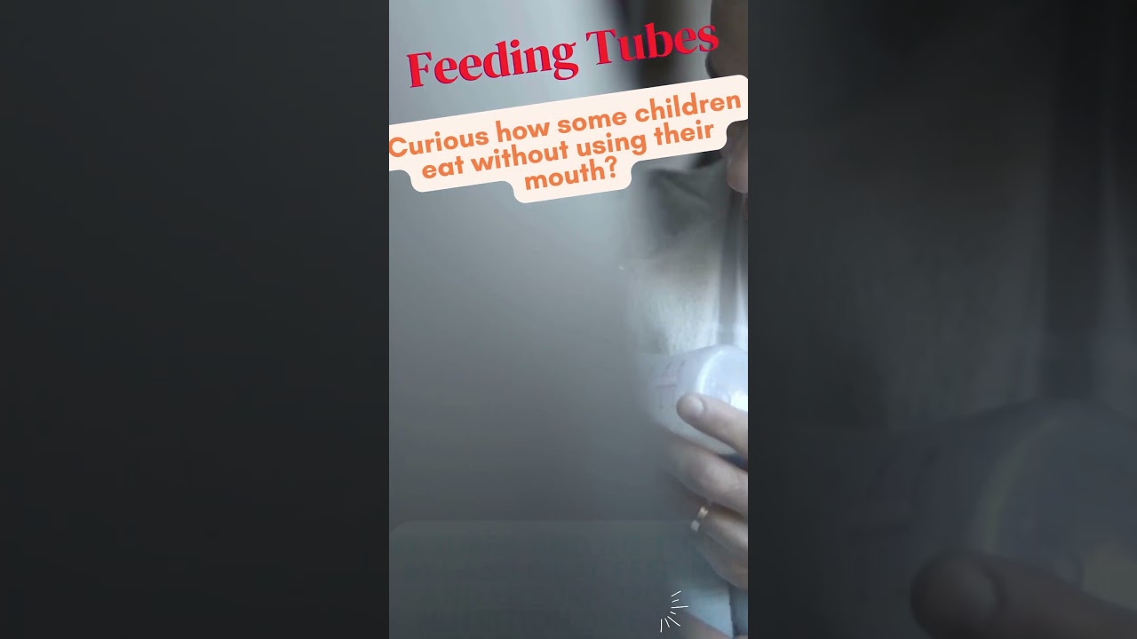 Feeding Tubes