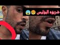 Rapmusic Rapper Music OUENZA DERBOH BOLICE LIVE INSTAGRAM OUENZA وانزة ضربو بوليسي Rapmusic Rapper Music OUENZA DERBOH BOLICE LIVE INSTAGRAM OUENZA وانزة ضربو بوليسي