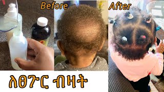 ባዶ ለሆነ ፀጉር ለብዛት ለእድገቱም ቤት የሚዘጋጅ የማሳደጊያና ማብዣ ለልጆች ላዋቂ ለወንዶች// this is how I grow back my baby’s hair!