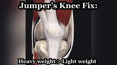 Jumper’s Knee: Putting the “Heavy” in Heavy Slow Resistance (Fix Patellar Tendon Pain)