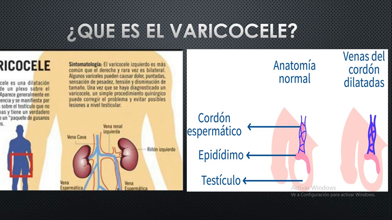 Por que salen lombrices