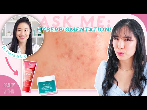 How to Reduce Acne Marks & Hyperpigmentation ft. @Peach & Lily