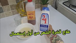 علاج قشرة الشعر نهائيا من أول استعمال مجربة و مضمونة  Traitement des pellicules