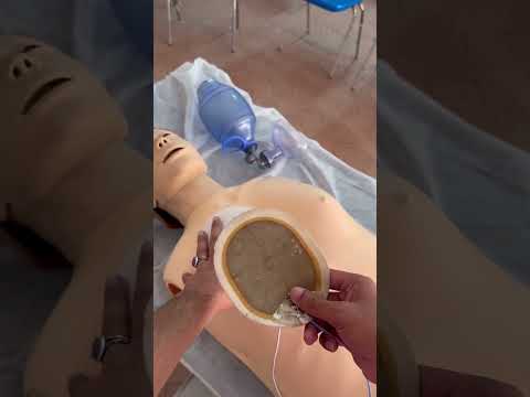 دستگاهی که ایست قلبی رو نجات میده واجبه دیدنش پزشکی  سلامتی پرستاری قلب دکتر بیماری