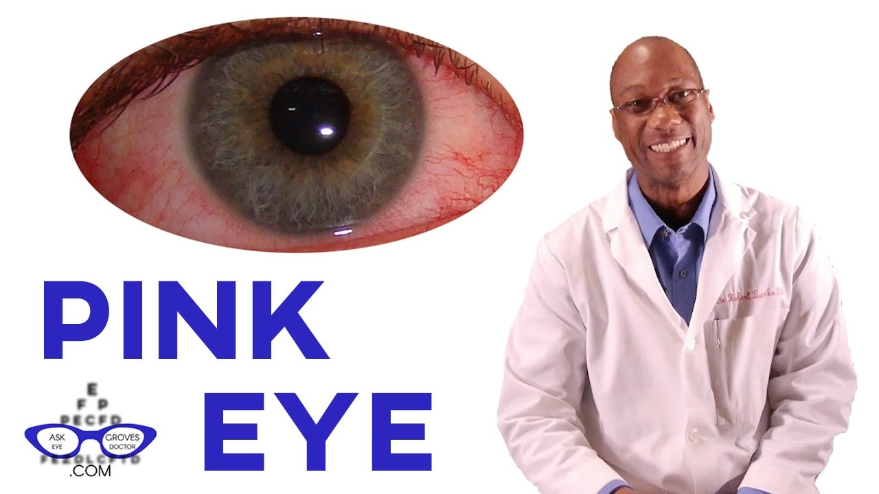 Dr Burke Why Does My Child Have Pink Eye A Grove OK Eye Doctor 