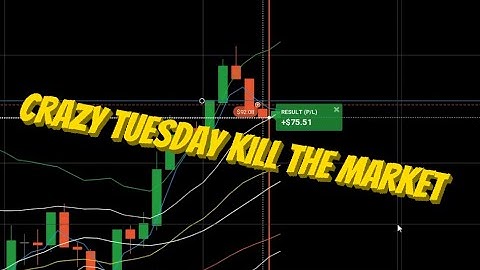 Real Money Day 10  ( BOTT Price Action Indicator 1.5.2 ) 📈 📉 IQ OPTION MT4 Trading 100% Win 2021
