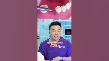 Trồng răng implant có niềng răng được không| Hoàng Tuấn