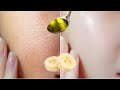 Baby Oil and Banana for skin whitening 10 shades, Removes wrinkles and dark Sports.