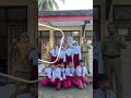 Monitoring TKA