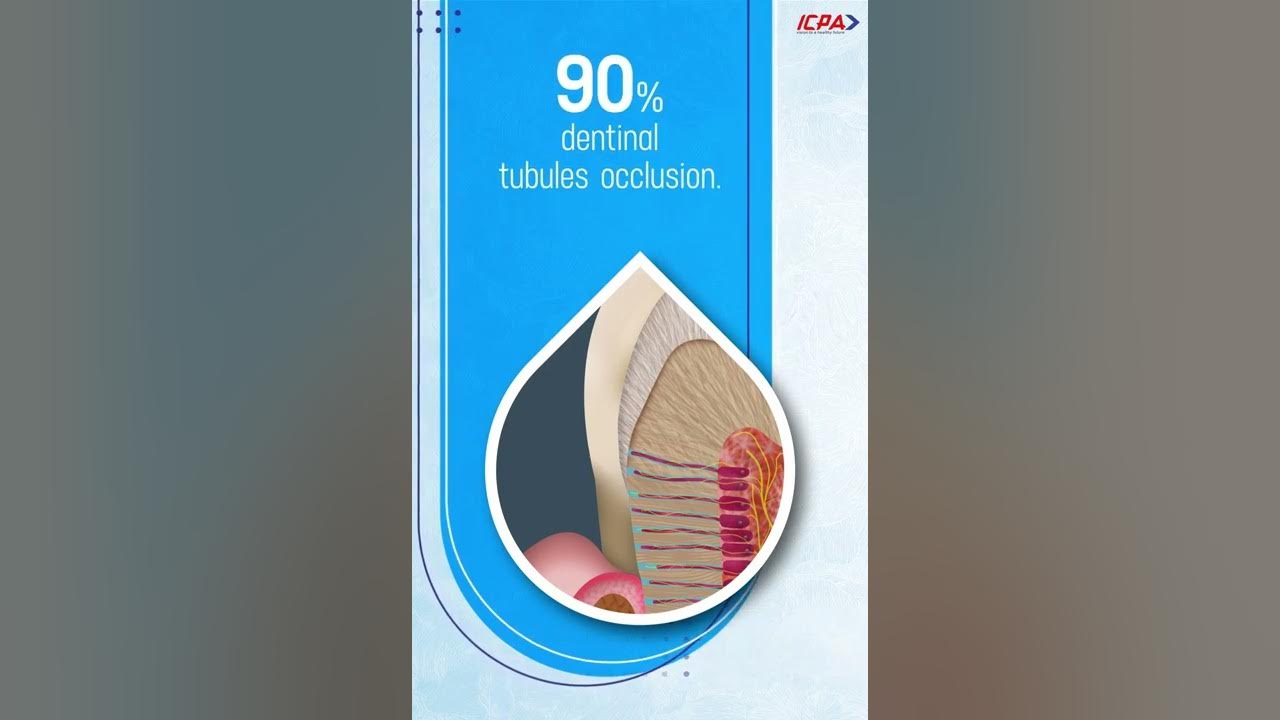 Thermoseal Repair A perfect solution for tooth wear and tear! YouTube