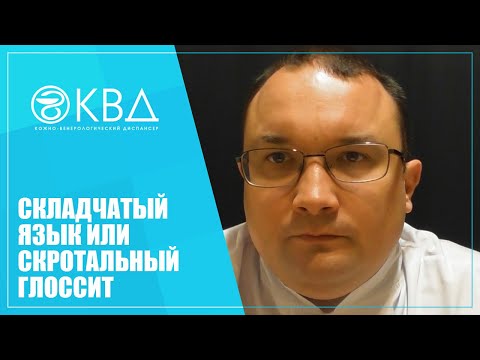 1303  Складчатый язык или скротальный глоссит