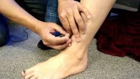 BALANCE METHOD 04: Systems 4, 5, 6 (Dr Romeo Gavino)