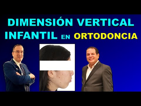 DIMENSI / KONTROL VERTIKAL ANAK DALAM ORTHODONTIK