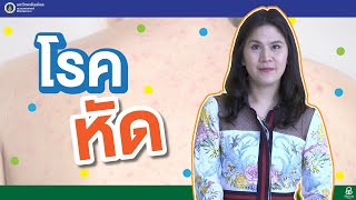 รายการสุขภาพดีศิริราช ตอน โรคหัด