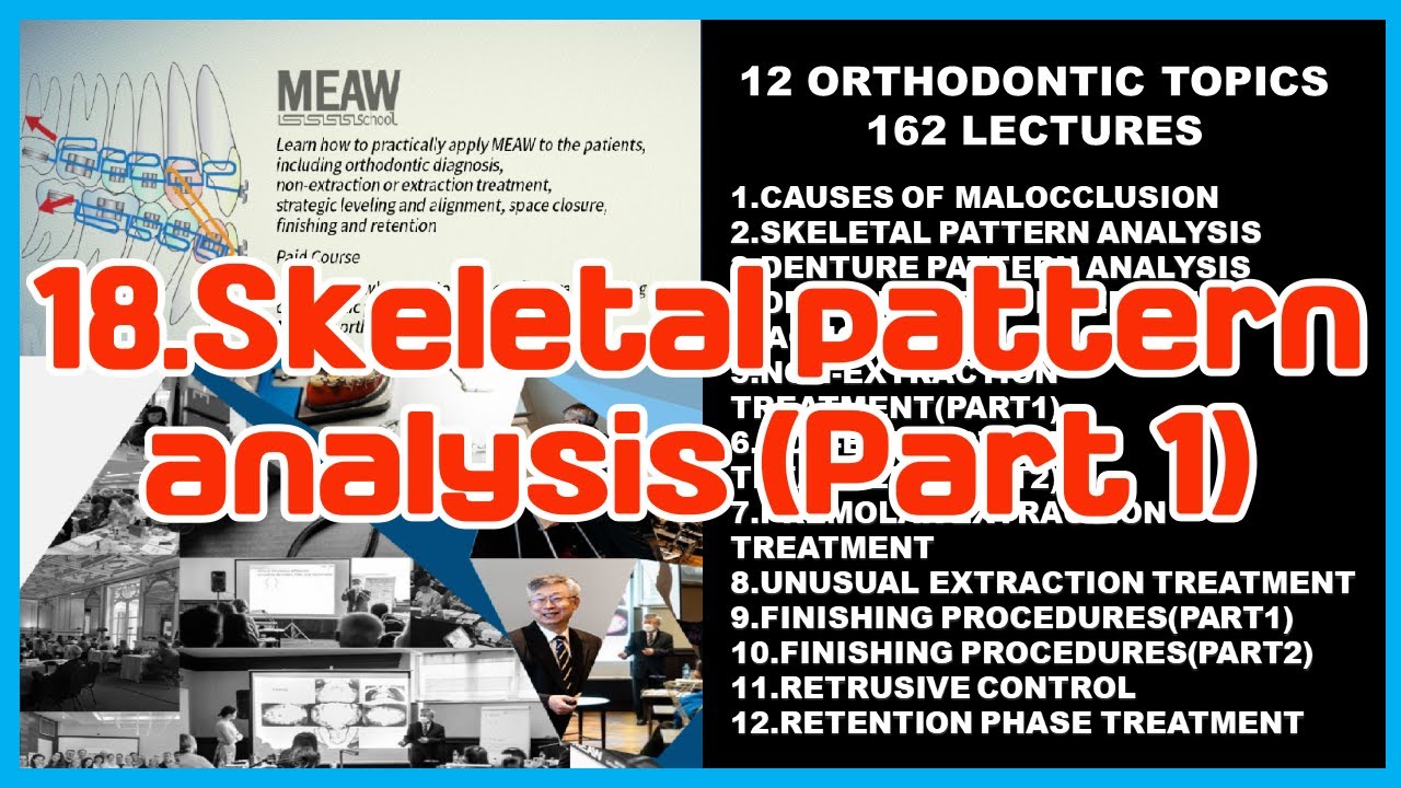 18.Skeletal pattern analysis (Part 1) - YouTube