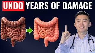 Gut Detox: The Fastest Way To Repair Your Gut Naturally (Backed by Science)