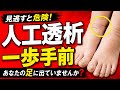 【腎臓ボロボロ】人工透析寸前の人の足は全員こうなります!