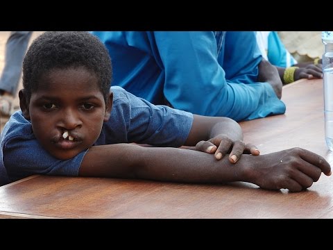 Dokumentation - Hilfe in Afrika - Schweizer Ärzte reisen nach Burkina Faso 2016