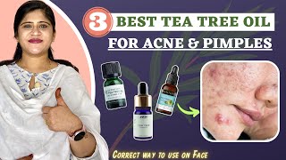 Top 3 Tea Tree Oil : For Acne & Pimples | Correct Way to use on Face | Dr. Arwa Bohra |