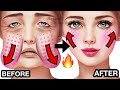 12 mins face lift exercises for jowls  laugh lines nasolabial folds try this while watching