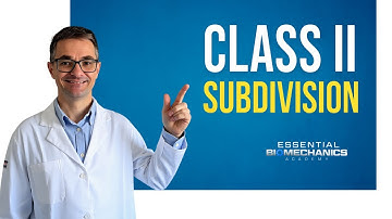 Class_II_Subdivision | Essential Biomechanics