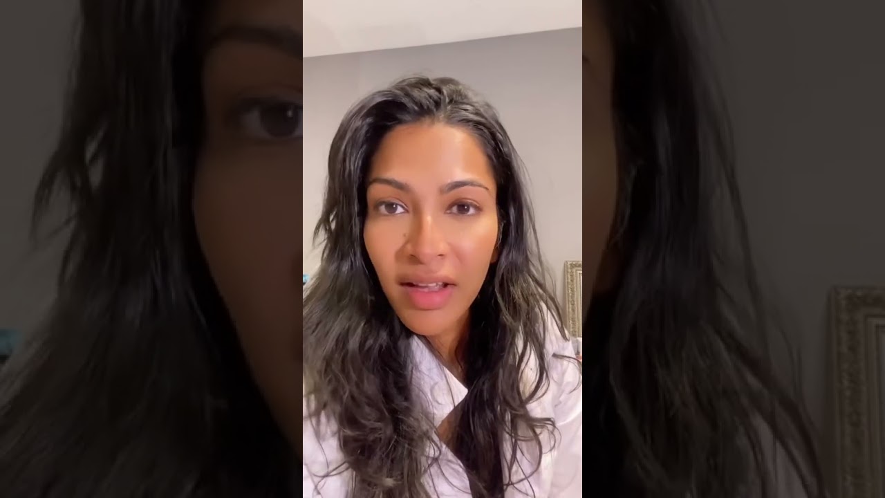 How long does filler last in the nose? #dermalfillers