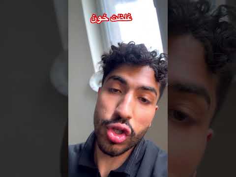 غلظت خون این که هر دردی رو میگن غلظت خون درسته چه طوری بفهمیم جوابش هس به راحتی از ازمایش ساده خون