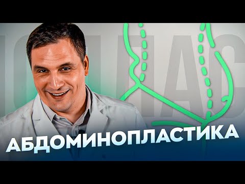 ВСЕ О АБДОМИНОПЛАСТИКЕ | ОПЕРАЦИЯ НА ЖИВОТЕ