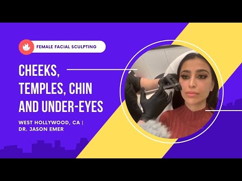 Female Facial Sculpting | Cheeks, Temples, Chin and Under-Eyes | West Hollywood, CA | Dr. Jason Emer