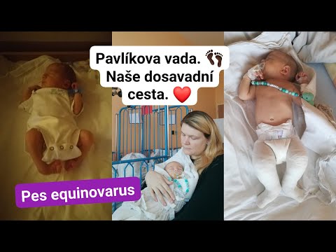 Pes Equinovarus - Pavlíkova vada. 👣 Naše dosavadní cesta. ❤️