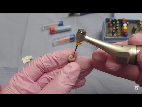 How to Do Rotary Instrumentation Step-by-Step(Dental Students MUST ...