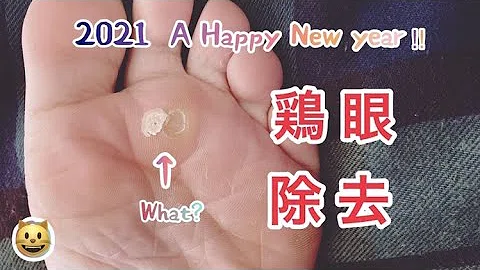 تحميل 魚の目 芯 抜く تحميل 魚の目 芯 抜く