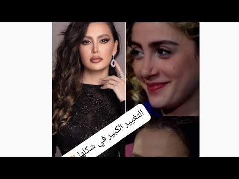 مرام العلي قبل التجميل والشهرة
